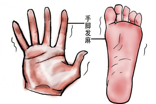 手腳經(jīng)常發(fā)麻是什么原因?手腳發(fā)麻可能患有哪些疾病？